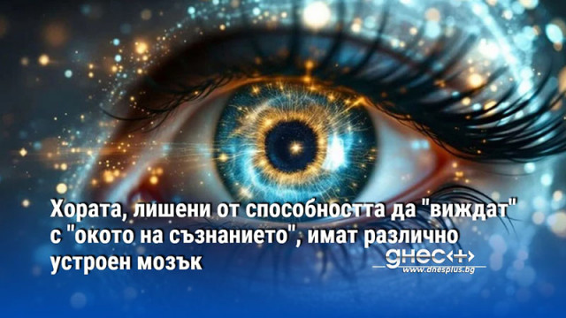 Хората, лишени от способността да "виждат" с "окото на съзнанието", имат различно устроен мозък